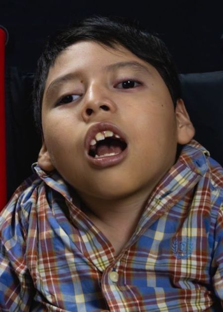 Fermin